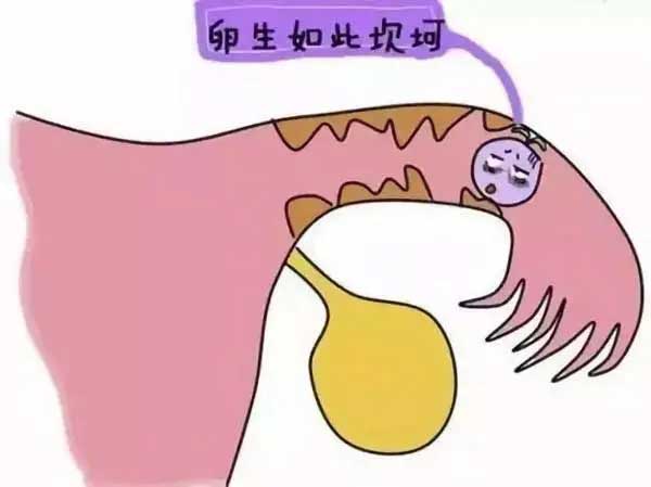 女人排卵障碍需及早发现