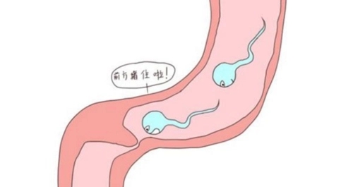 输精管堵塞引起男性不育的3种原因