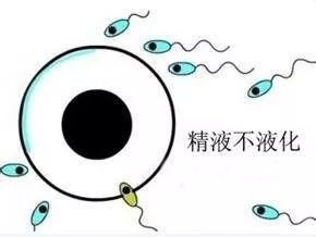精子不液化是什么原因造成的?