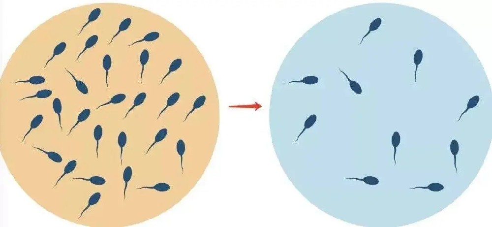 这些因素容易引起少精症，千万注意!